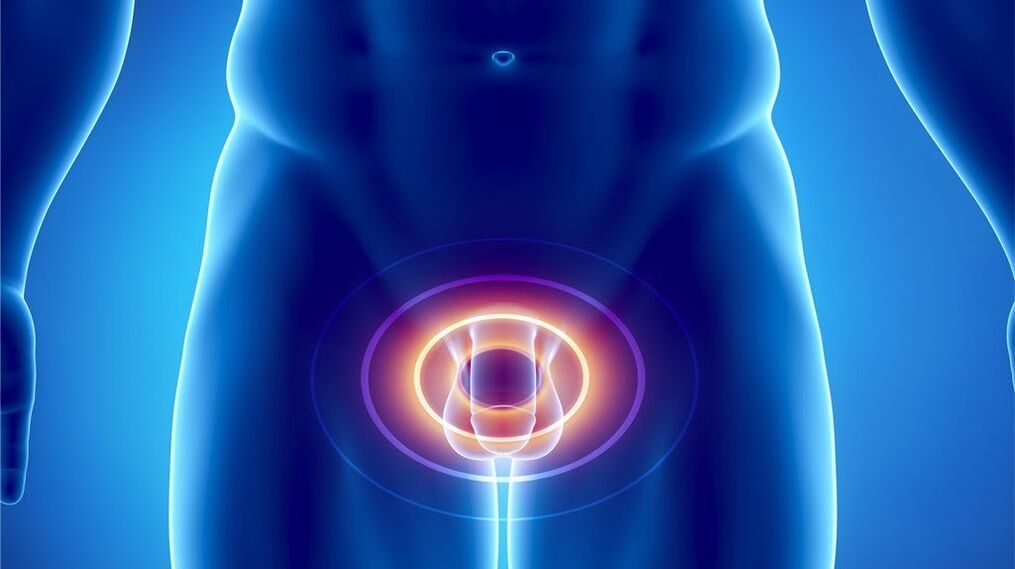 prostatitis in men and the cause of its appearance