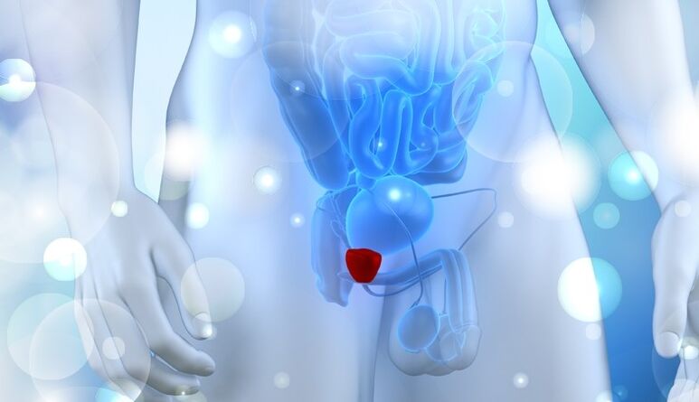 Vesiculite on men