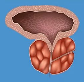 Signs -The characteristics of prostatitis