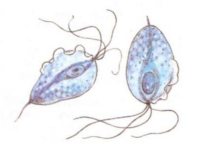 The causative agent of prostatitis is Trichomonas